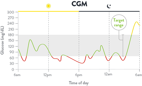 Chart illustrating continuous readings throughout the day with CGM